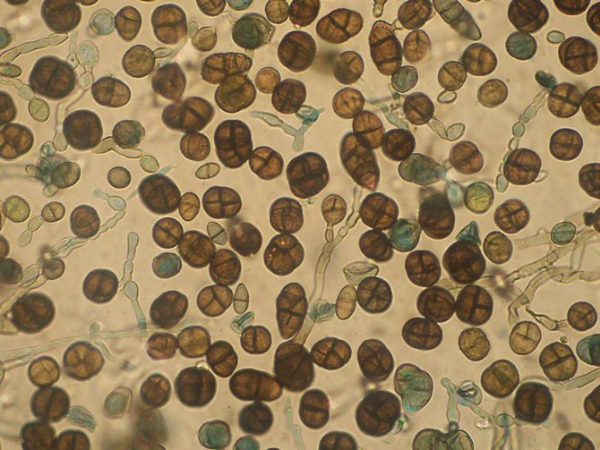 Ucolcladium под микроскопом